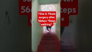 Tibia fibula surgery after 56days upstairs walking  Leg fracture exercises flatfoot [upl. by Edgell433]