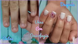 COMO HACER UÑAS ACRÍLICAS EN UÑAS MORDIDAS ONICOFAGIA [upl. by Waters]