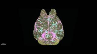 WholeBrain Imaging of Cancer Metastasis VIDEO [upl. by Ralston262]