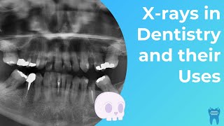 Types of Dental Xrays you NEED to know  Dental Radiographs and Why we use them [upl. by Arivle]