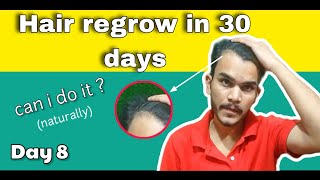 how to reduce hairfall naturally at home  30 days hair regrow naturally maturing hairline [upl. by Staci]