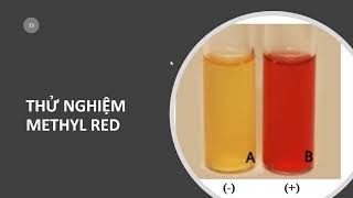 Thử nghiệm Indol  Ure  Methyl Red  Voges Proskauer [upl. by Acinomaj]