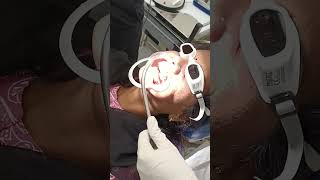 Surgical excision of fibroma from maxillary gingiva with laser [upl. by Eyllib]