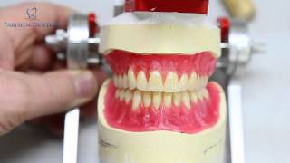 How Dentures Are Made [upl. by Heise28]