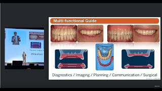 Immediate full arch restoration using the Straumann® Pro Arch treatment approach [upl. by Malet975]