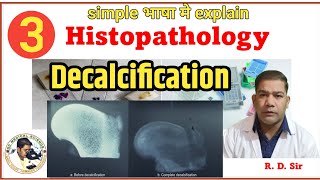 Decalcification in histopathology  Decalcification in hindi [upl. by Herring]