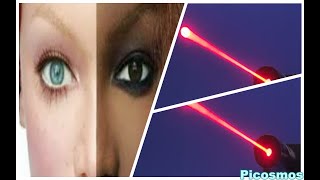 Des rayons laser pour blanchir sa peau [upl. by Notyarb]