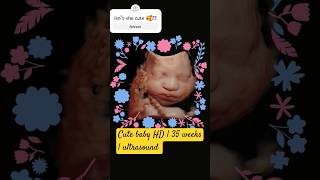 Cutest little thing  HD Ultrasound  35 weeks pregnancy baby shorts [upl. by Akerboom]