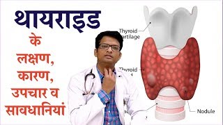 Thyroid disease causes symptoms amp treatment  थायराइड के लक्षण कारण उपचार व सावधानियां [upl. by Marinna]