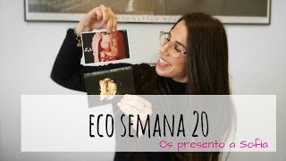 Ecografia 4D 20 semanas Ecox 4D [upl. by Anwadal]