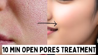 10 Minutes Open Pores Home Remedy [upl. by Neillij]