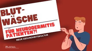 Blutwäsche Eine Behandlungsoption für Neurodermitis Patienten [upl. by Clea717]