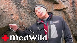 Wilderness Medicine Sleep Problems At Altitude [upl. by Asihtal181]