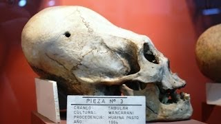 Secret Filming Of Odd Elongated Human Skulls In Bolivia [upl. by Acassej]