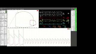 A Cardioprotective Mindset Myocardial Energetics and Ventricular Unloading in Cardiogenic Shock [upl. by Yentihw276]