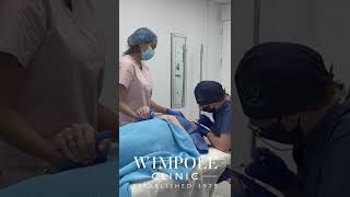 Alexs Hair Transplant Journey  Wimpole Clinic London [upl. by Beatriz248]