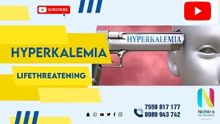 HYPERKALEMIA  LIFETHREATENING [upl. by Llorrac]