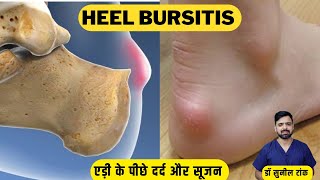 3 Easy Retrocalcaneal Bursitis Exercises for Quick Pain Relief  एडी में दर्द और सूजन का घरेलू इलाज [upl. by Emrich]