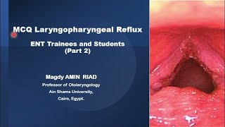 MCQ Laryngopharyngeal Reflux ENT Trainees and Students Part 2 [upl. by Imnubulo]