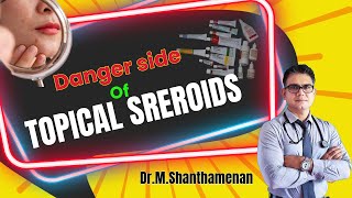 Danger side of Topical steroids  DrShanthamenan healthy skincare healthylifestyle doctor [upl. by Yeblehs]