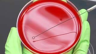 3 Streaking for IsolationSubculturesStrep Pyogenes wStamp4 [upl. by Byrle]