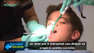 De ce este recomandat aparatul dentar pentru copii  Clinicile Dentare Dr Leahu [upl. by Hatfield327]