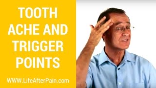 Toothache and Trigger Points [upl. by Garlanda]