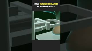 HOW MAMMOGRAPHY IS PERFORMED  3D ANIMATION [upl. by Aissela395]