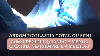 Abdominoplastia ou mini abdominoplastia  a menor cicatriz é sempre a melhor opção [upl. by Ailegave]