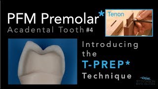 PFM Premolar Using TPREP Technique  Acadental Tooth 4 [upl. by Byers]