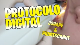 PrimeScanne vs Trios 3  Scanner Intraoral [upl. by Yadnus]