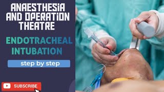 endotracheal intubation [upl. by Niltag]