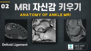 MRI 자신감키우기02 Deltoid ligament Ankle MRI anatomy tibiotalar ligament 군자출판사 [upl. by Alderman]