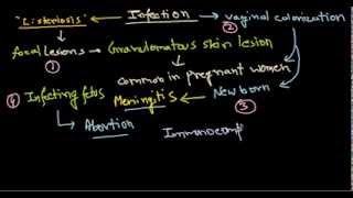 Listeria monocytogenes infection [upl. by Bullion733]