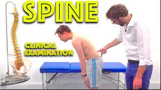 Spine Examination  Back Pain Assessment  4K  Clinical Skills  Dr Gill [upl. by Patin]