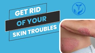 GET RID OF YOUR SKIN RASH  BEST WAY TO VANISH UR SKIN DISEASES  Homeopathy with Dr Anoosha Hashmi [upl. by Zsa300]