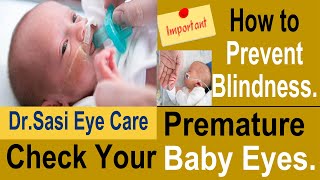 Prevent Blindness  Premature Babies  Check your Baby Eyes Immediately  DrSasi [upl. by Vtehsta136]