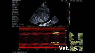 Dilated Cardiomyopathy DCM [upl. by Aylatan]