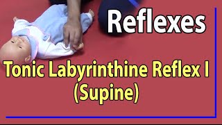 08 Tonic Labyrinthine Reflex I  Supine [upl. by Hpotsirhc]