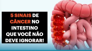 5 Sinais de CÂNCER no Intestino que você NÃO DEVE IGNORAR [upl. by Medrek588]