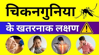 Chikungunya ke Lakshan Kya Hai Signs amp Symptoms of Chickungunya [upl. by Doughty]