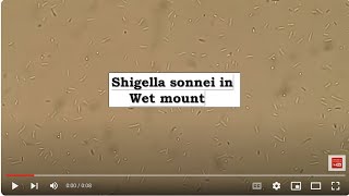 Shigella sonnei in Wet mount Microscopy [upl. by Haroun285]