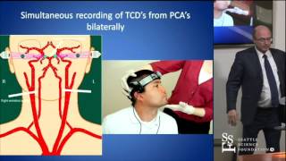 Head Turn Syncope Rotational Vertebrobasilar Ischemia by David Newell MD [upl. by Pollak]