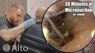 30 Minutes of MICROSUCTION Ear Wax Removal [upl. by Straus924]