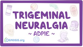 Trigeminal neuralgia Nursing Process ADPIE [upl. by Alyosha]