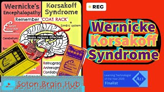 Wernickes Korsakoff Syndrome [upl. by Cirle]