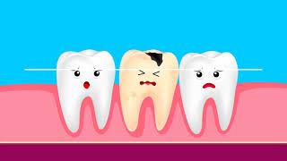 HCPCS Level II Modifiers for AmbulanceTransportation and Dental Coding [upl. by Schnorr]