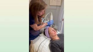 Skin Rejuvenation  Microneedling [upl. by Nageek285]