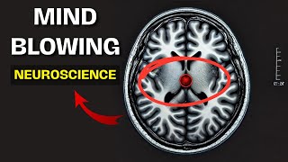 SplitBrain Surgery The Hidden Truth About Free Will and Consciousness  MindBlowing Neuroscience [upl. by Leesen]