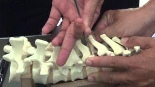 APSS Workshop Video 2 Thoracic Pedicle Screw [upl. by Bradan]